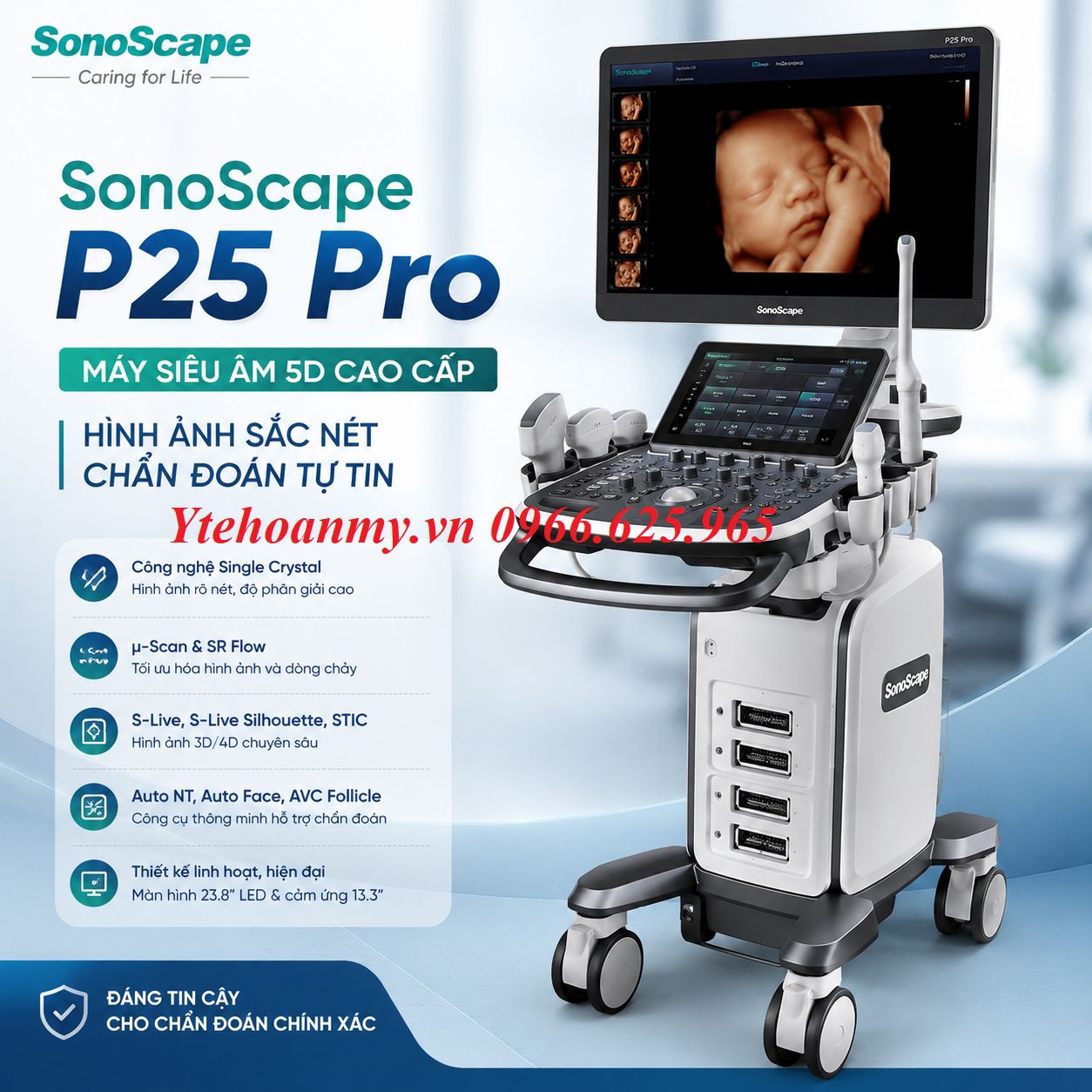 Tổng hợp các mẫu máy siêu âm 5D SonoScape đang được bán nhiều nhất tại Việt Nam